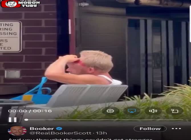 Video :A guy from Nashville was seen minus a portion of his skull